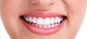 Estética Dental com Lentes de Contato