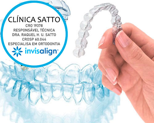Ortodontia Invisalign